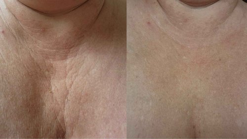 Hyaluronic Rejuvenating Serum for Face & Body 3.34 oz, Natural, Non-greasy, with Vitamin B5 and Niacinamide