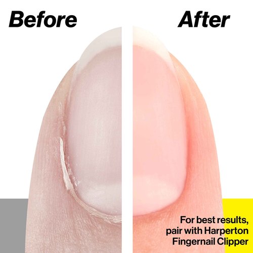 Nail Clippers Set + Cuticle Trimmer, Stainless Steel Ingrown Toenail Tool, Professional Fingernail & Toenail Clippers for Thick Nails, Non-Slip Cuticle Nipper Stainless Steel Cutter Fingernails and To