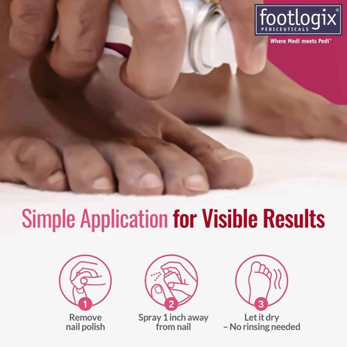 FOOTLOGIX Nail Tincture Spray with Spiraleen, 1.69 Fl Oz (Pack of 1)