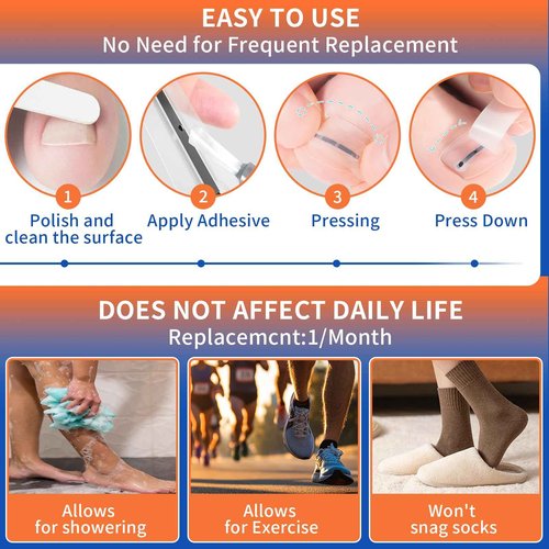 5 Sizes, 10 Pcs - Ingrown Toenail Treatment Kit, Titanium Alloy Ingrown Toenail Removal Kit, Nails Corrector Tool & Remover Strips - Ingrown Toe Nail Quick Relief(0.51/0.59/0.67/0.7/0.74 inches)