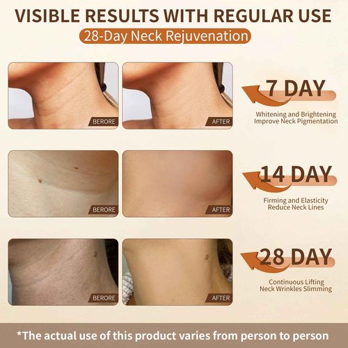 Sheework Neck Firming Cream,Tighten and Lift Neck Cream,Neck Tightening Cream Improves Sagging,Skin Tightening and Smooth of Fine Lines