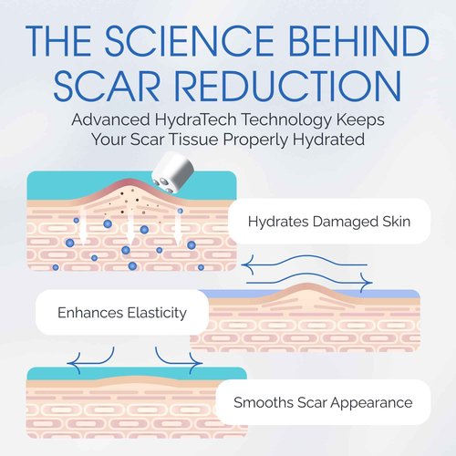 100% Silicone Scar Gel Cream Serum – Silicone + Massage Power Duo Scar Therapy w/Tri-Roller Tip for Surgical, C-Section, Acne, Burn & Keloid Bump Scars – Hypoallergenic & Fragrance Free