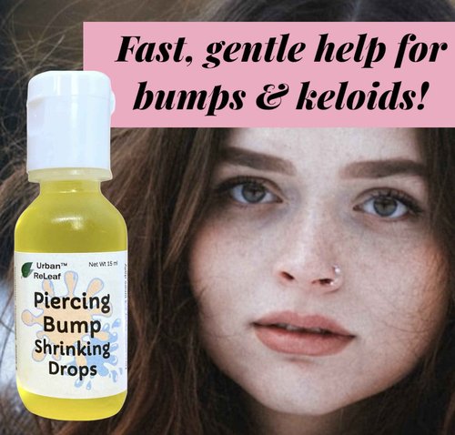 Set Urban ReLeaf Piercing Bump Shrinking Drops & Piercing Relief Solution ! Gentle, Effective Aftercare. Fast Help for Irritated, Keloid, Fussy & Problem Piercings, 100% Natural with Essential Oils.