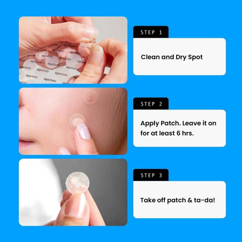 AVARELLE Pimple Patches Double Variety Duo Hydrocolloid Acne Patches, for Blemishes and Zit with Tea Tree Oil, Calendula Oil and Cica Oil for Face, Vegan, Cruelty Free (80 Count + Variety)