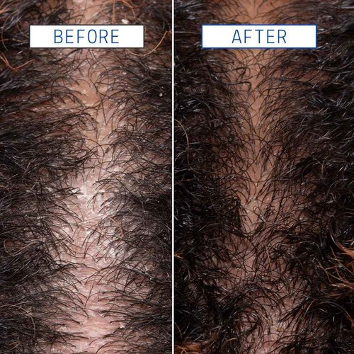 AAVRANI Scalp Detox Jelly Cleanser - Sulfate-Free Clarifying Shampoo - with Glycolic Acid & Vitamin E to Remove Build Up and Excess Oil - Color-Safe - Vegan - 8.4 Fl Oz