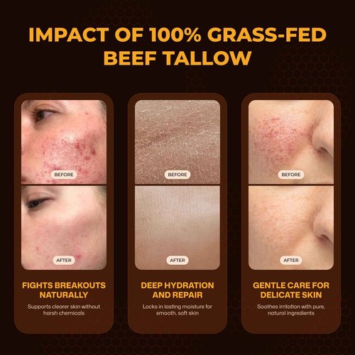 VIORY Tallow and Honey Balm for Face, Beef Tallow for Skin, Moisturizer with 100% Organic Grass-Fed Beef Tallow & Raw Wild Honey - Natural Formula for Dry & Sensitive Skin (Unscented)
