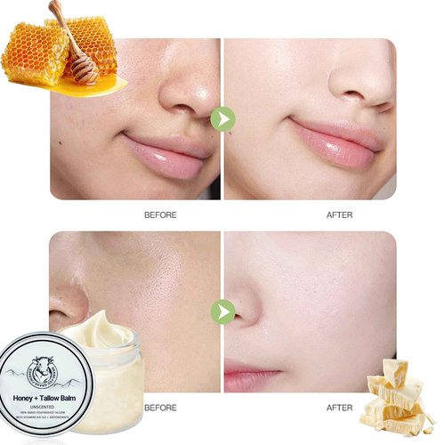 NEWUREHO Grass Fed Honey & Tallow Balm, Grass Fed Beef Tallow Manuka Honey Cream, Miracle Tallow Balm Face and Body For Skin, Organic Moisturizing Cream Smooth Skin