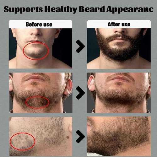 Para Barba, Estimulante De Barba, Beard Balm for Men, Crecimiento De Barba Para Hombre, Mustache Wax, Bálsamo Para Barba, Original Moisturizes & Strengthens Para Crecer La Barba Rapido Beard (1 PCS)