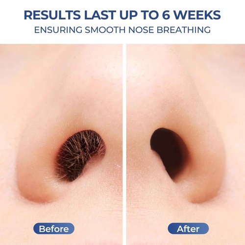 SUERBEATY Nose Wax Kit Men, Nose Hair Wax Kit with 100 g Nose Wax, Use 20 Times, Nose and Ear Hair Removal Kit For Men, USB Fast Heat, Constant Temperature, Multi-Accessories, Travel Use, Light Black
