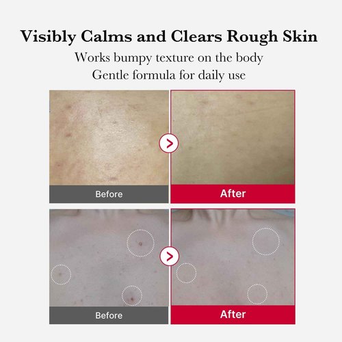 medicube Red Exfoliation & Tone-Care Duo: Red Body Peeling Shot and Red Succinic Acid Panthenol Facial Peeling Pads