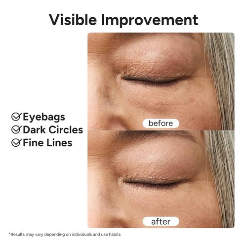 Eye Repair Gel Cream - Under Eye Cream with Caffeine & Lutein, Anti-Wrinkle and Firming, Treatment to Reduce Dark Circles, Fine Lines & Puffiness, 0.5 oz.