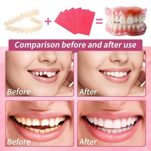 Denture Do it Yourself Full Set of Top and Bottom Fake Teeth, for Improve Smile, DIY Kit Easy and Convenient, Fake Teeth Repair Missing Teeth, Protect Your Teeth-JJ13
