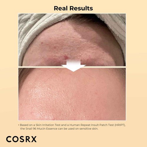 COSRX Ultimate Hydration Repair Duo - Hyaluronic Acid Intensive Cream + Snail Mucin 96% Essence, Long-lasting Intense Hydration and Skin Repair Care