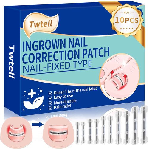 5 Sizes, 10 Pcs - Ingrown Toenail Treatment Kit, Titanium Alloy Ingrown Toenail Removal Kit, Nails Corrector Tool & Remover Strips - Ingrown Toe Nail Quick Relief(0.51/0.59/0.67/0.7/0.74 inches)