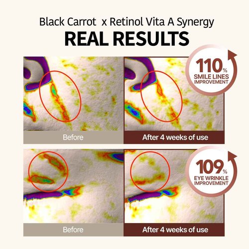 GOODAL Black Carrot Retinol Cream 1.69 fl.oz (50ml) – Beginner Friendly Korean Skin Care Moisturizer with Retinol, Niacinamide, Pore minimizer – 48H Lasting Hydration, Anti-Aging, Daily Cream