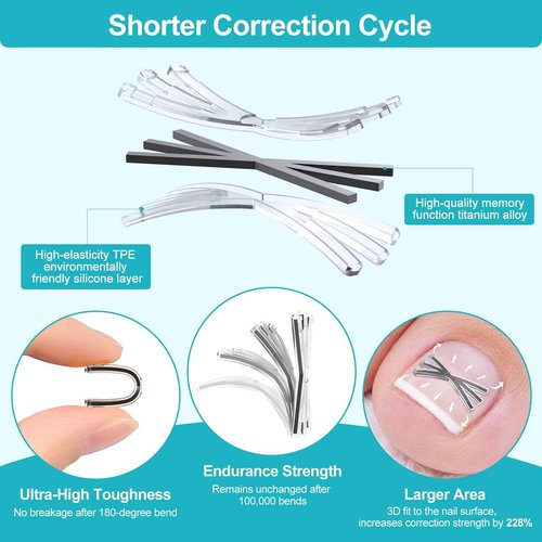 Ingrown Toenail Treatment Kit with Upgraded 6-Angle Shape,Titanium Alloy Ingrown Nail Corrector Tools with 4 Multi-Sizes,Ingrown Toe Nail Relief Remover Strips for Curved Toenail Quick Relief,8Pcs