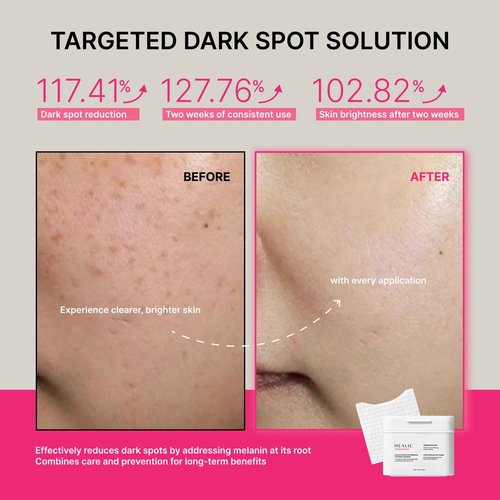 Healic Toning Active Pad – Dual-Textured Toner Pads for Brightening, Hydrating, and Soothing with Tranexamic Acid & Hyaluronic Acid – Gentle for Sensitive Skin, Korean Skin Care, Vegan, 70 Pads