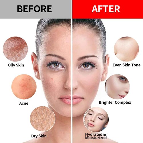 Nielies Vampire & 24K Gold Jelly Mask, Facial Skin Care- Collagen Peel-Off Jelly Mask Set, Jelly Mask For Facials, Hydrojelly Masks,Vegan Peel Off Face Mask, For Brightening & Nourishing