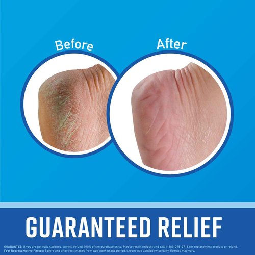 O'Keeffe's Lip Repair Night Treatment Lip Balm.25 Ounce Jar, (Pack of 1) & O'Keeffe's for Healthy Feet Foot Cream, 3.2 oz, Jar