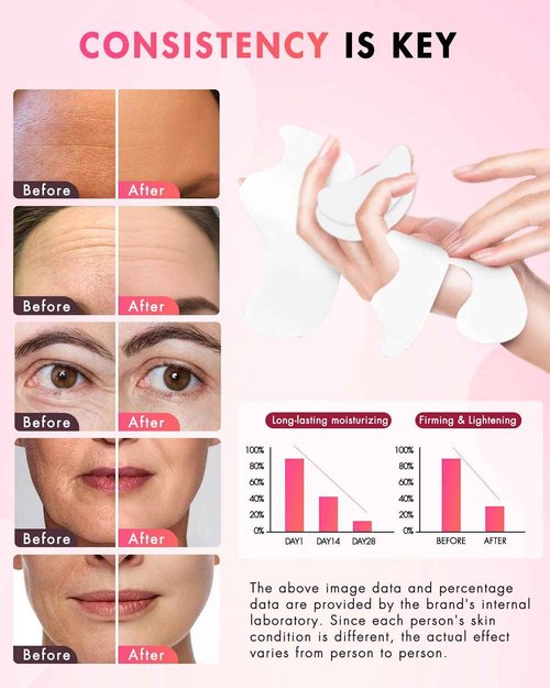 UKVOA Forehead Wrinkle Patches & Smile Line Patches & Under Eye Patches, Overnight Facial Wrinkle Treatment with Hyaluronic Acid, Aloe, Collagen & Vitamin E to Lift Smile Lines for Women 60pcs