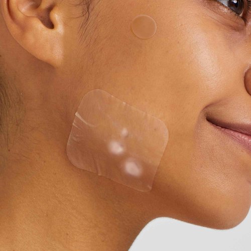 AVARELLE Pimple Patches Double Variety Duo Hydrocolloid Acne Patches, for Blemishes and Zit with Tea Tree Oil, Calendula Oil and Cica Oil for Face, Vegan, Cruelty Free (80 Count + Variety)