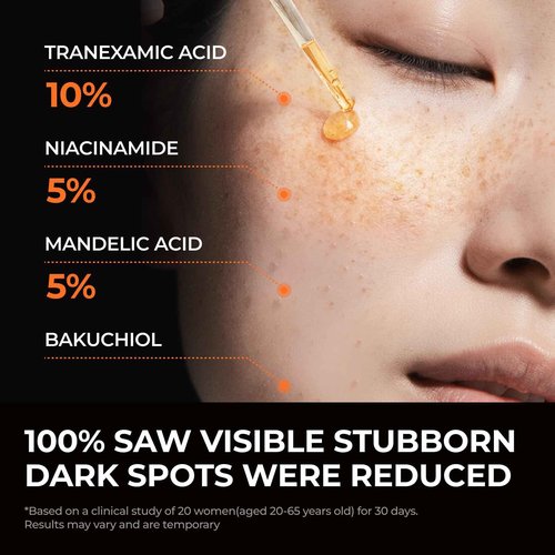 DOMINAS 10% Tranexamic Acid + 5% Mandelic Acid + 5% Niacinamide Brightening Serum, Powerful Dark Spot Corrector for Face, Fast Results in 2 Weeks, 1.01 fl oz