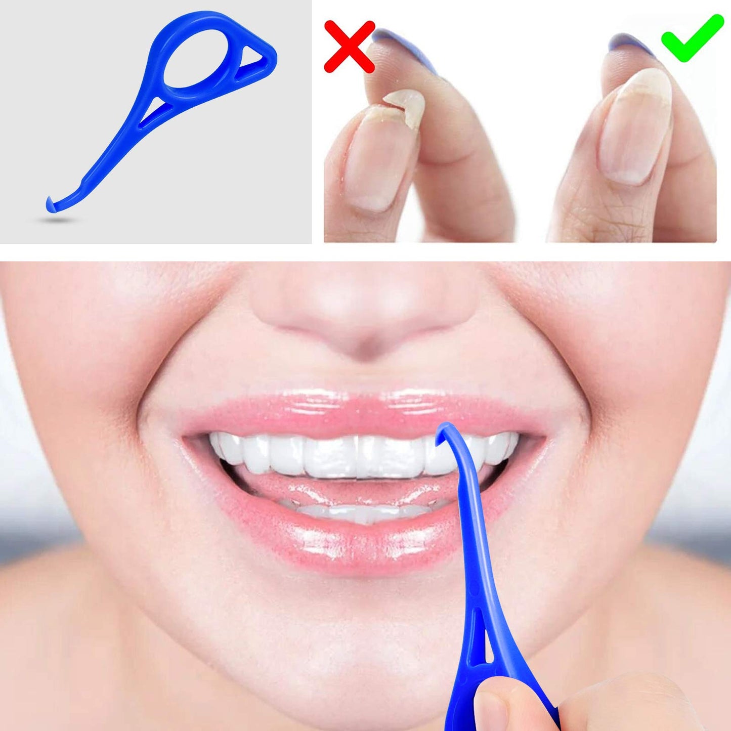 Clear aligner removal tool-invisible removable braces, invisible aligner remover-aligner remover-fixer remover (dark blue 20+ pink 20)