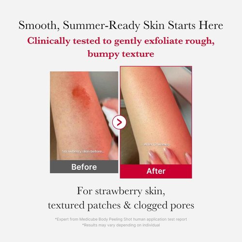 medicube Red Exfoliation & Tone-Care Duo: Red Body Peeling Shot and Red Succinic Acid Panthenol Facial Peeling Pads