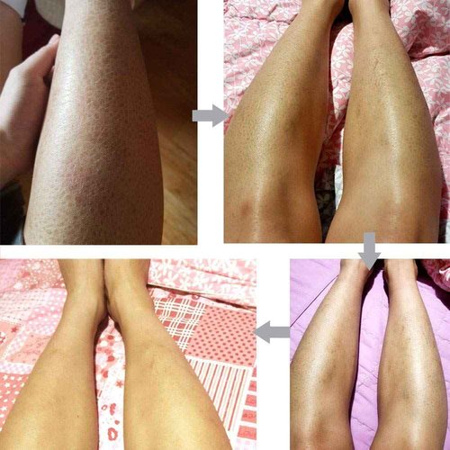 Dr.Deep Real Body Lotion 10.6 fl.oz | Natural Body Cream for Dry Skin | Moisturizing Cream for Dry Skin | Cracked Skin Repair Cream Moisturizer | Dry Skin Cream | Body Lotion for Dry Skin