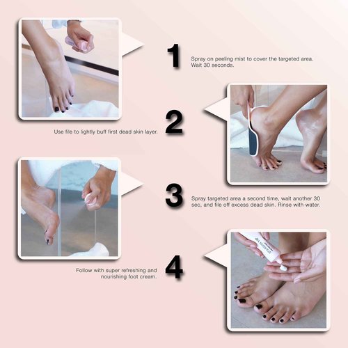 STARSKIN Fab Feet Fast, Instant Foot Peeling Spray, Foot File & Foot Cream for Soft & Smooth Skin, Premium Callus Remover for Rough Cracked & Dry Feet