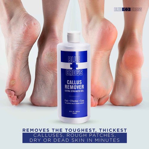 Blue Cross Hydrating, Moisturizing, Strengthening Cuticle Remover Oil with Lanolin + Extra Strength Callus Remover Gel for Heel or Feet, 32 oz each, 2 pack Professional Bundle