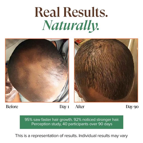 Kreyol Essence - Haitian Black Castor Oil for Skin and Hair, Glass Bottle - Cold Pressed, Hexane Free, Fuller-Looking Hair, Natural Humectant, Mango Papaya & Coconut, 3.4 Fl Oz