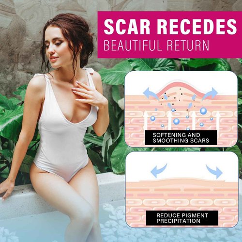 Silicone Scar Sheets, 8 Pcs Medical Grade & Reusable Breast Silicone Scar Tape for Surgical Scars