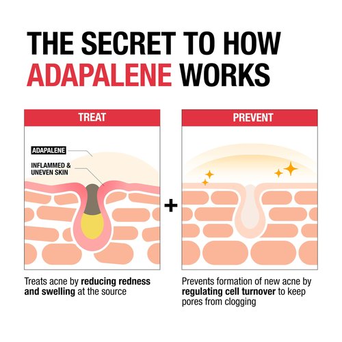 Neutrogena 0.1% Adapalene Gel Acne Treatment, Topical for Acne, Adapalene Medication for Blemishes, Once Daily Topical Retinoid to Prevent Breakouts, Oil & Fragrance-Free, 1.6 oz