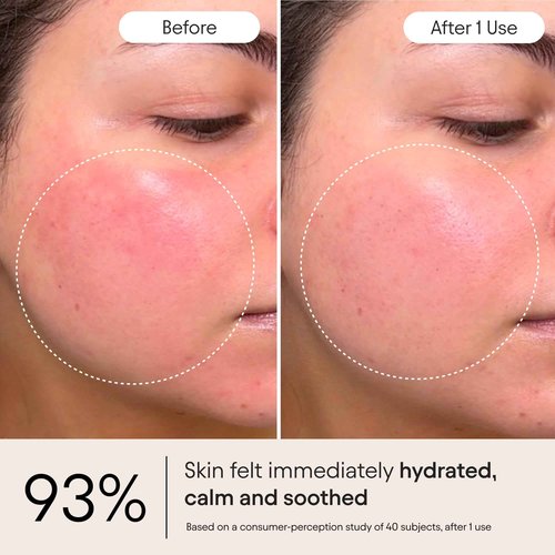 Alpyn Super Peptide & Ghostberry Moisturizer for Eczema, Barrier & Wrinkle Repair | Calm & Soothe Against Redness & Irritation (0.5 Oz)