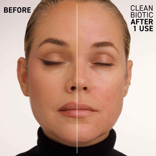Dr. Brandt Skincare Clean Biotic, 3.5 oz.