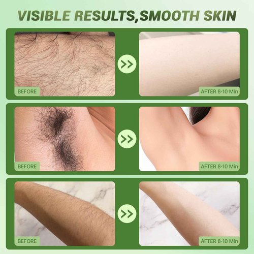Hair Removal Cream For Women - Painless Body Hair Remover Sensitive Skin Hair Removal For Back Legs Fast And Gentle 6.76 Fl Oz