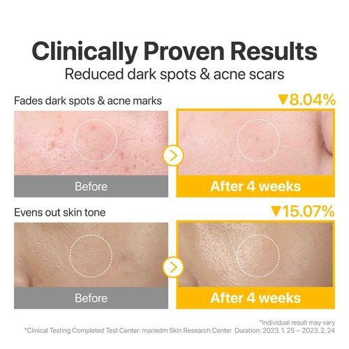 numbuzin No.5 Glutathione Dark Spots Set