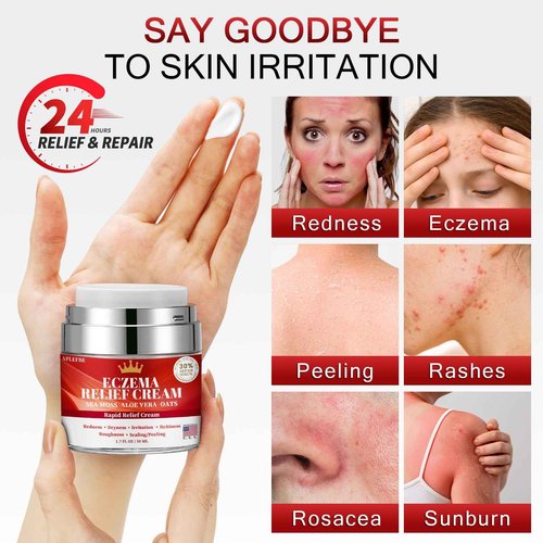 Eczema Cream for Kids & Adults - Eczema Relief Cream for Redness, Itchy, Dry Skin, Daily Moisturizer for Sensitive Skin, with Sea Moss, Aloe Vera, Colloidal Oatmeal, Fragrance-Free, 1.7 FL OZ, 2PC