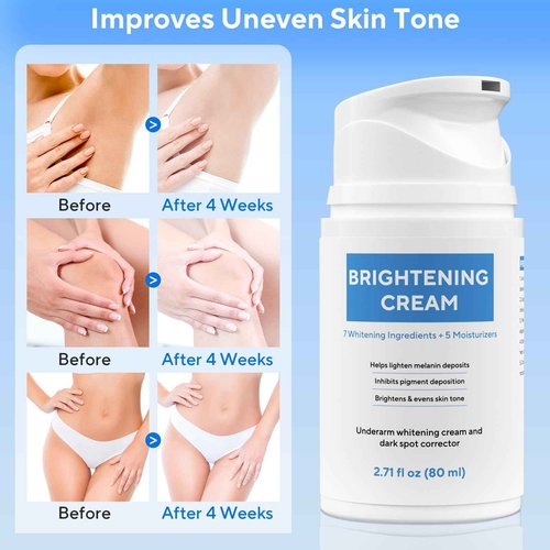 Skin Bleaching Cream, Dark Spot Remover for Body and Face, 2.71 fl oz Skin Lightening Whitening Cream with Vitamin C for Intimate Parts, Armpit, Inner Thigh, Dark Elbows and Knees, Bikini Areas