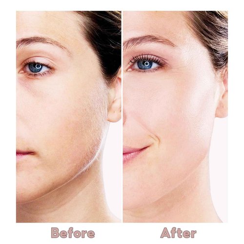 Facial Hair Removal for Women, Painless Hair Remover Device Lady Face Electric Razor for Lip, Chin,arms with USB Rechargeable Included 2 pc Replacement Heads