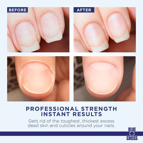 Blue Cross Hydrating, Moisturizing, Strengthening Cuticle Remover Oil with Lanolin + Extra Strength Callus Remover Gel for Heel or Feet, 32 oz each, 2 pack Professional Bundle