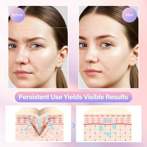 Neck and Face Care Device for Home Daily Use, Skin Care Tool, Wrink-le Improve, Firm, Tightening and Smooth White