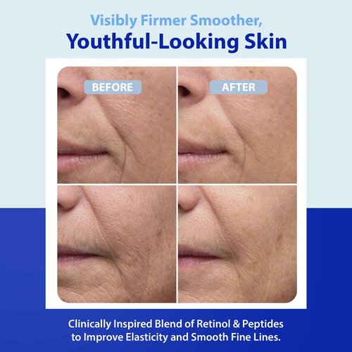Dr. Denese HydroShield Dream Cream 1.7 oz – Advanced Moisturizer with Ceramides, Retinol and Peptides for Smooth Radiant Skin, Improved Elasticity and Deep Hydration – Doctor Developed, Cruelty Free