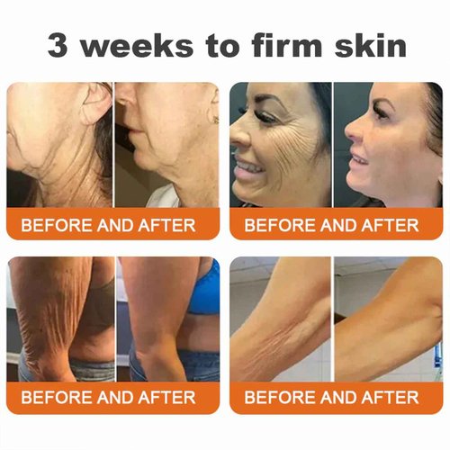 APKAPK Bee Venom Skin Restoration Cream, Advanced Firming & Wrinkle-Reducing, Professional Bee Venom Skin Treatment Cream, Natural bee venom comprehensive cream for All Skin Types (2 Pack)