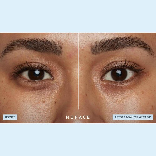 NuFACE IonPlex Hydra-Gel Power Under Eye Patches - Gel Under Eye Mask for Puffy Eyes & Dark Circles - Cooling Wrinkle Patches & Hydrating Treatment Pads to Energize, Brighten & Tighten (60 Count)