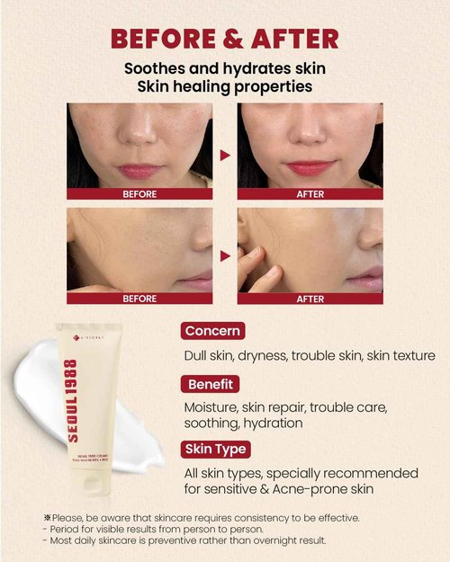 K-SECRET SEOUL 1988 Snail Mucin 93% Cream – Concentrated Yet Lightweight Formula Infused with 93% Snail Mucin | Non-Sticky & Fast-Absorption Facial Cream | Korean Skincare, 100ml / 3.38 fl oz