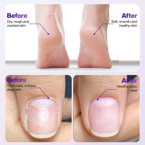 Professional Electric Nail Drill 2000mAH Portable Cordless Electric Nail File 10 in 1 Manicure Pedicure Kit ,5-Speeds Toe Nail Tools Hand Foot Care,Thick Toenail Grinder for Women Men Pets (Purple)
