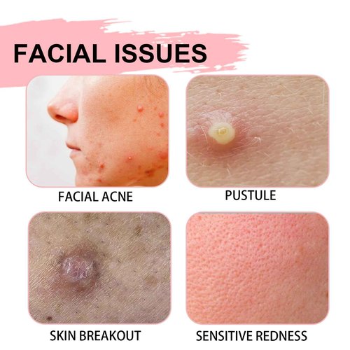 YAMFIUY Centella Moisturizer Phytocin Cream - Phytocin Cream, Moisturizer & Hydration, Improve Roughness, Smooth Skin, For Sensitive Skin with Natural Centella Asiatica Extract 2pcs