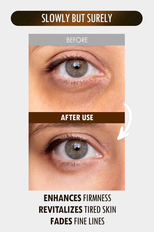SUR.MEDIC+ 24K Gold Perfection All In One Cream for Face & Eye with Hyaluronic Acid, Panthenol and 24 Gold 1.18 oz